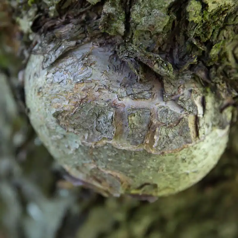 치료는 어떻게?